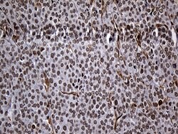 RAD21 Monoclonal Antibody (OTI6C10), TrueMAB , OriGene:Antibodies:Primary