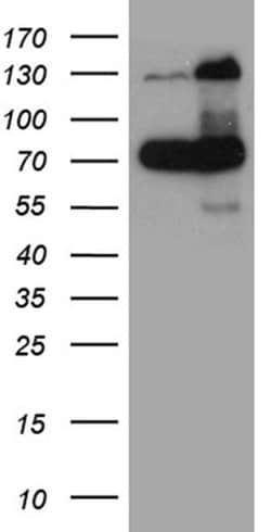 RAD21 Monoclonal Antibody (OTI2A12), TrueMAB , OriGene 100 &mu;L; Unconjugated:Antibodies,