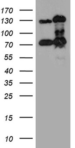 RAD21 Monoclonal Antibody (OTI6C10), TrueMAB , OriGene 100 &mu;L; Unconjugated:Antibodies,