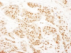 RAD23B Rabbit anti-Human, Mouse, Rat, Polyclonal, Bethyl Laboratories 100