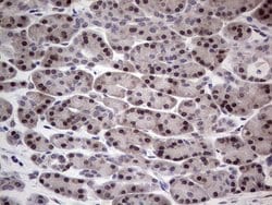 RAD23B Monoclonal Antibody (OTI7G10), TrueMAB , OriGene 100 &mu;L; Unconjugated:Antibodies,