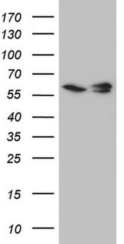 RAD23B Monoclonal Antibody (OTI7F11), TrueMAB , OriGene 30 &mu;L; Unconjugated:Antibodies,