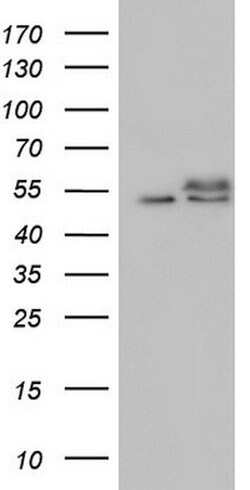 RAD23B Mouse anti-Human, Clone: OTI13A3, lyophilized, TrueMAB 100 &mu;g | Buy Online | Origene Technologies | Fisher Scientific