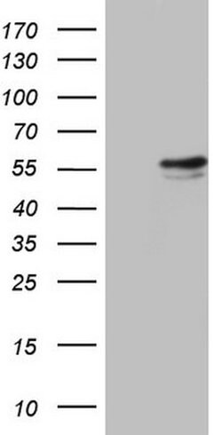 RAD23B Mouse anti-Human, Clone: OTI7C5, lyophilized, TrueMAB 100 &mu;g;