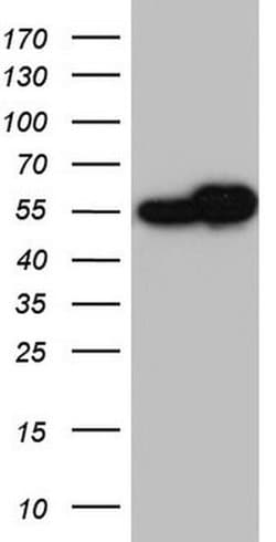 RAD23B Monoclonal Antibody (OTI12C10), TrueMAB , OriGene:Antibodies:Primary