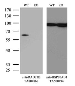 RAD23B Monoclonal Antibody (OTI12C10), TrueMAB , OriGene:Antibodies:Primary