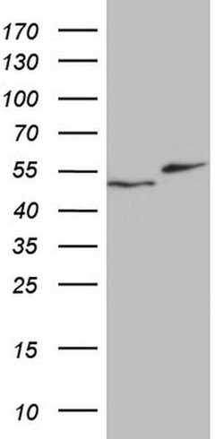 RAD23B Monoclonal Antibody (OTI13A2), TrueMAB , OriGene:Antibodies:Primary