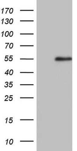 RAD23B Monoclonal Antibody (OTI8E5), TrueMAB , OriGene 30 &mu;L | Buy Online | Origene Technologies | Fisher Scientific