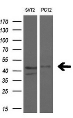 RAD51L1 Mouse anti-Human, Clone: OTI7H4, lyophilized, TrueMAB 100 &mu;g;