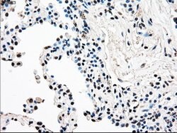 RAD9A Mouse anti-Human, Clone: OTI7B11, lyophilized, TrueMAB 100 &mu;g;