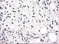 RAD9A Mouse anti-Human, Clone: OTI7B11, lyophilized, TrueMAB 100 &mu;g;