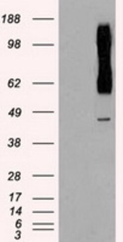 RAD9A Mouse anti-Human, Clone: OTI7B11, lyophilized, TrueMAB 100 &mu;g;