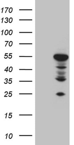 RAGE Mouse anti-Human, Mouse, Clone: OTI6C12, lyophilized, TrueMAB 100