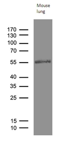RAGE Mouse anti-Human, Mouse, Clone: OTI6C12, lyophilized, TrueMAB 100
