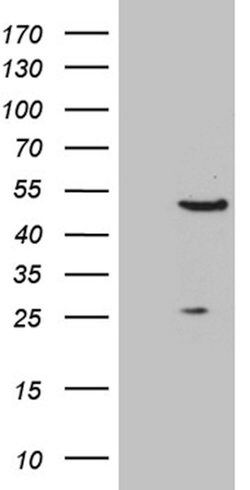 RAGE Mouse anti-Human, Mouse, Clone: OTI9G8, lyophilized, TrueMAB 100 &mu;g;
