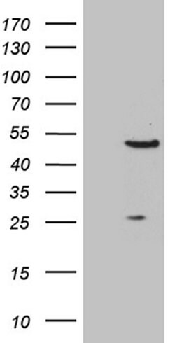RAGE Monoclonal Antibody (OTI9G8), TrueMAB , OriGene:Antibodies:Primary