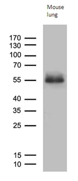 RAGE Mouse anti-Human, Mouse, Clone: OTI9G8, lyophilized, TrueMAB 100 &mu;g;