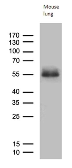 RAGE Monoclonal Antibody (OTI9G8), TrueMAB , OriGene 100 &mu;L; Unconjugated:Antibodies,