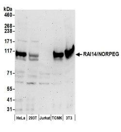 RAI14/NORPEG Polyclonal Antibody, Bethyl Laboratories 20 &mu;L | Buy Online | Bethyl Laboratories, Inc | Fisher Scientific