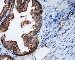 RALBP1 Monoclonal Antibody (OTI1E2), TrueMAB , OriGene 30 &mu;L; Unconjugated:Antibodies,