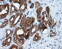 RALBP1 Monoclonal Antibody (OTI1E2), TrueMAB , OriGene 30 &mu;L; Unconjugated:Antibodies,