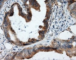 RALBP1 Monoclonal Antibody (OTI1E2), TrueMAB , OriGene 30 &mu;L; Unconjugated:Antibodies,