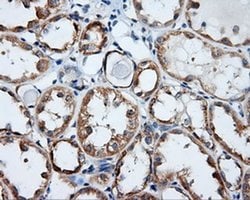 RALBP1 Monoclonal Antibody (OTI1E2), TrueMAB , OriGene 30 &mu;L; Unconjugated:Antibodies,