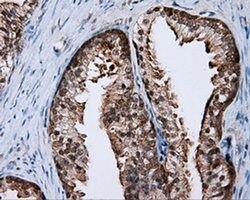 RALBP1 Monoclonal Antibody (OTI6E8), TrueMAB , OriGene 30 &mu;L; Unconjugated:Antibodies,