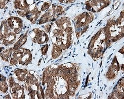 RALBP1 Monoclonal Antibody (OTI6E8), TrueMAB , OriGene 30 &mu;L; Unconjugated:Antibodies,