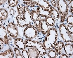 RALBP1 Monoclonal Antibody (OTI6E8), TrueMAB , OriGene 30 &mu;L; Unconjugated:Antibodies,