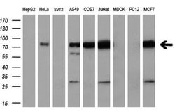 RALBP1 Monoclonal Antibody (OTI11C6), TrueMAB , OriGene 100 &mu;L; Unconjugated:Antibodies,