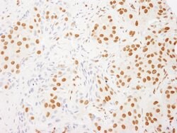RALY Rabbit anti-Human, Polyclonal, Bethyl Laboratories 100 &mu;l; Unlabeled:Antibodies,