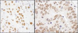 RALY Rabbit anti-Human, Mouse, Polyclonal, Bethyl Laboratories 100 &mu;L;