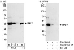 RALY Rabbit anti-Human, Mouse, Polyclonal, Bethyl Laboratories 100 &mu;L;
