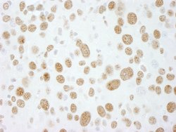 RALY Polyclonal Antibody, Bethyl Laboratories 100 &mu;l; Unlabeled:Antibodies,