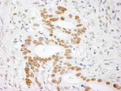 RALY Polyclonal Antibody, Bethyl Laboratories 100 &mu;l; Unlabeled:Antibodies,
