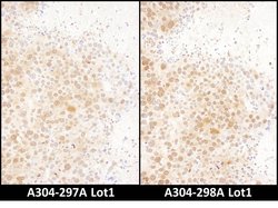 RAN Rabbit anti-Human, Mouse, Polyclonal, Bethyl Laboratories 100 &mu;L | Buy Online | Bethyl Laboratories, Inc | Fisher Scientific