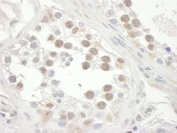 RAP1 Rabbit anti-Human, Polyclonal, Bethyl Laboratories 100 &mu;L; Unconjugated:Antibodies,