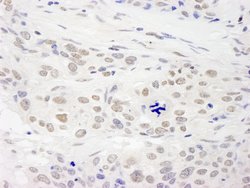 RAP1 Polyclonal Antibody, Bethyl Laboratories 10 &mu;L; Unconjugated:Antibodies,