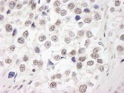RAP80 Polyclonal Antibody, Bethyl Laboratories:Antibodies:Primary Antibodies