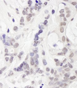 RAP80 Polyclonal Antibody, Bethyl Laboratories 100 &mu;l; Unlabeled:Antibodies,
