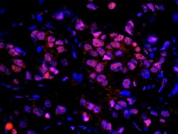 RAP80 Polyclonal Antibody, Bethyl Laboratories 100 &mu;l; Unlabeled:Antibodies,