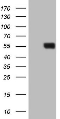 RARA Monoclonal Antibody (OTI7B9), TrueMAB , OriGene 100 &mu;L; Unconjugated:Antibodies,
