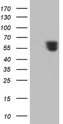 RARA Mouse anti-Human, Clone: OTI2B4, lyophilized, TrueMAB 100 &mu;g; Unconjugated:Antibodies,