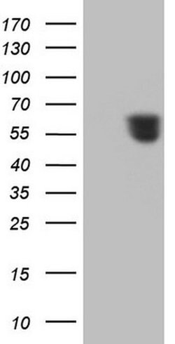 RARA Monoclonal Antibody (OTI2B4), TrueMAB , OriGene:Antibodies:Primary