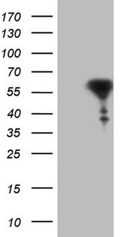 RARA Monoclonal Antibody (OTI7B8), TrueMAB , OriGene 100 &mu;L | Buy Online | Origene Technologies | Fisher Scientific