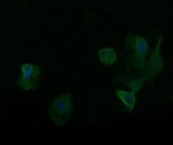 RARRES1 Monoclonal Antibody (OTI1A6), TrueMAB , OriGene:Antibodies:Primary