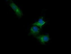 RARRES1 Mouse anti-Human, Clone: OTI1H2, lyophilized, TrueMAB 100 &mu;g;