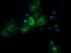 RARRES1 Mouse anti-Canine, Human, Mouse, Rat, Clone: OTI1B3, lyophilized,