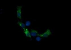 RARRES1 Monoclonal Antibody (OTI1A7), TrueMAB , OriGene 100 &mu;L; Unconjugated:Antibodies,